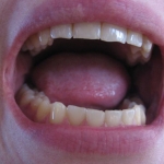 What Part of “No,” Don’t You Understand?