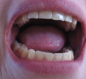 What Part of “No,” Don’t You Understand?