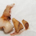 Forgiveness is a Pain